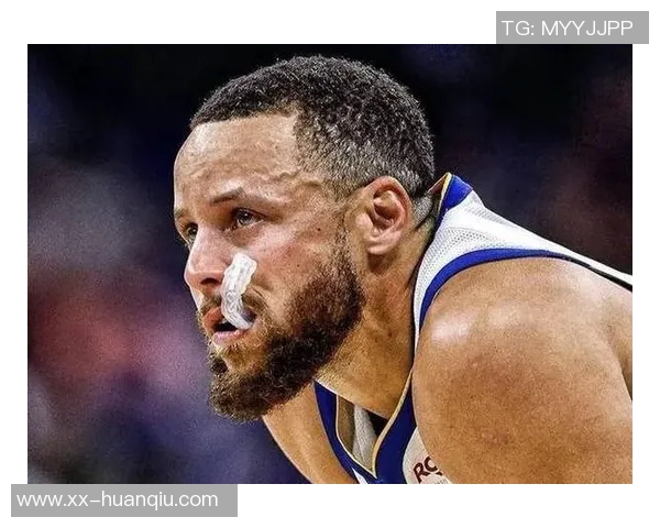 勇士官方宣布库里股四头肌受伤一周后将进行复查评估